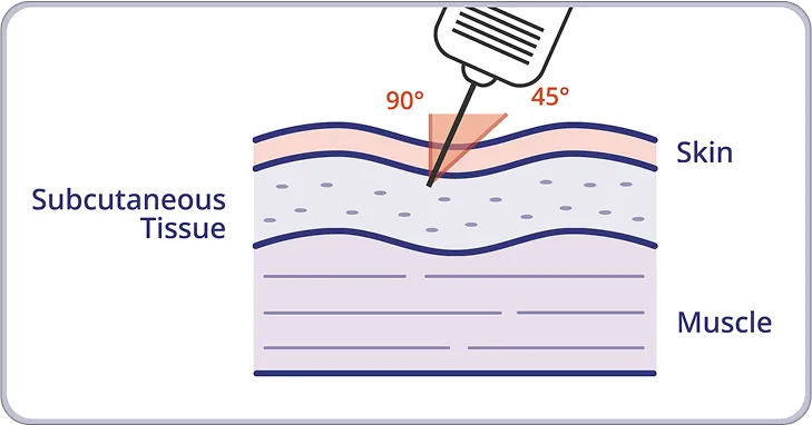 SUBCUTANEOUS INJECTION